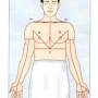 chest-incision.jpg