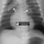 hrt-spinnaker_thymic_sail_sign.jpg