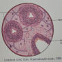 umbilical_cord.png